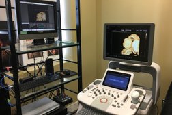 UC Baby 3D Ultrasound Photo