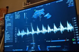 Prenatal Peek 3D4D Ultrasound in Winnipeg
