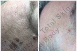 Total Skin & Body Anti Aging Spa Photo